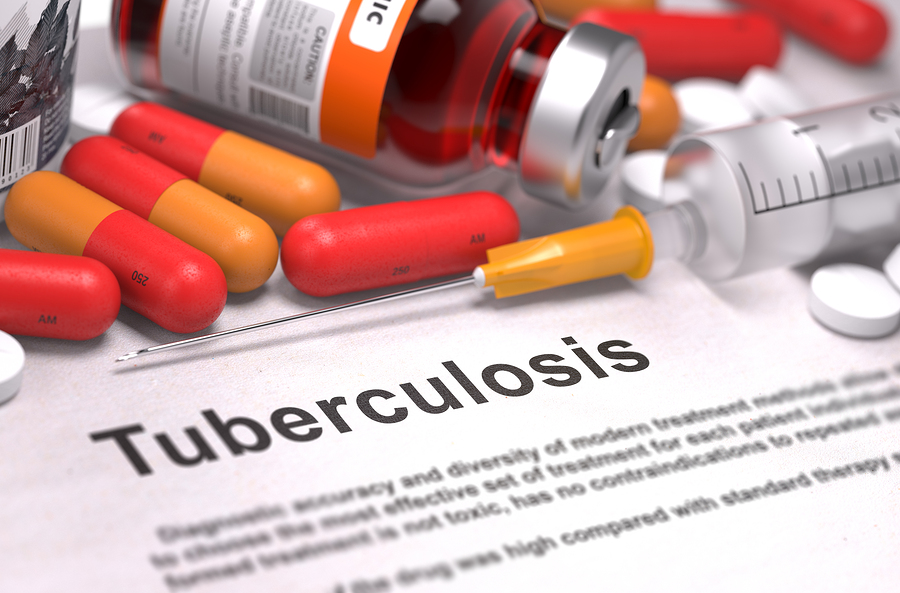 Homeopathy helps treat drugresistant tuberculosis