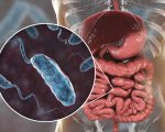 Cholera History: The Homeopathic Treatment and Prevention of Cholera (Part A) History: The Homeopathic Treatment and Prevention of Cholera (Part A) 1