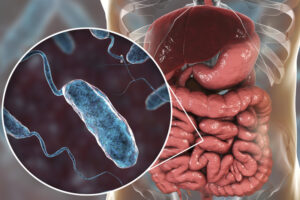 History: The Homeopathic Treatment and Prevention of Cholera (Part A)