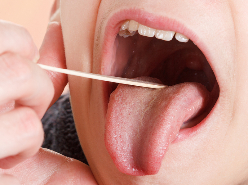 An image of someone's mouth wide open being inspected for inflamed tonsils