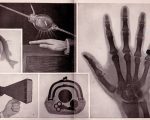 X rays1 A Study of Homeopathic X-ray A Study of Homeopathic X-ray 1