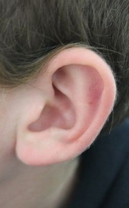 Homeopathic Treatment for Ear Infections Better than Antibiotics 11