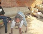 1779802 759256867437424 2128755976 n Miracle homoeopathy drug brings hope for leprosy patients Miracle homoeopathy drug brings hope for leprosy patients 1