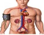 Hypertension - Fundamentals and Homeopathic Remedies 3