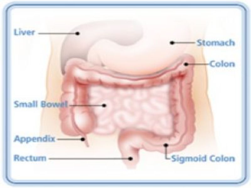 Crohn’s Disease and Colitis 2