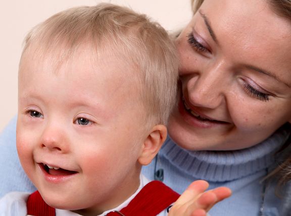 Homeopathy in Down Syndrome 2