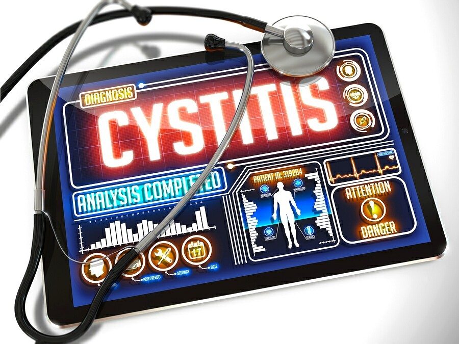 9 Remedies for Cystitis 7