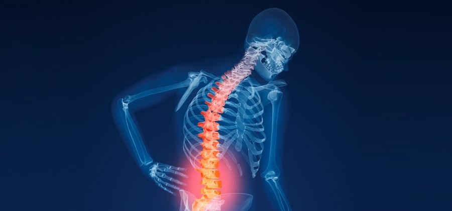 Homeopathy For Osteoporosis | Homeopathy Plus