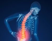 Homeopathy for Prevention and Treatment of Osteoporosis 2