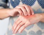 Itchy Remedies to Scratch Your Itch Remedies to Scratch Your Itch 1