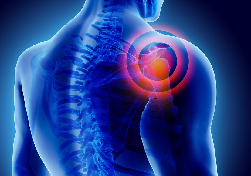 Homeopathy for Frozen Shoulder 2