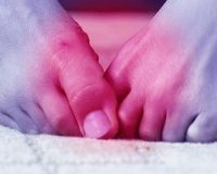 Homeopathic Gout Remedies 2