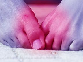 Homeopathic Gout Remedies 7