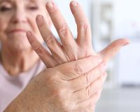 Arthritis: Homeopathy Compared 5