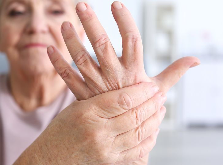 Arthritis: Homeopathy Compared 8