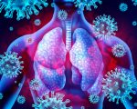 Pneumonia NL Homeopathic Remedies for Pneumonia-Related Symptoms Lung Infection with Pneumonia (Viral)
