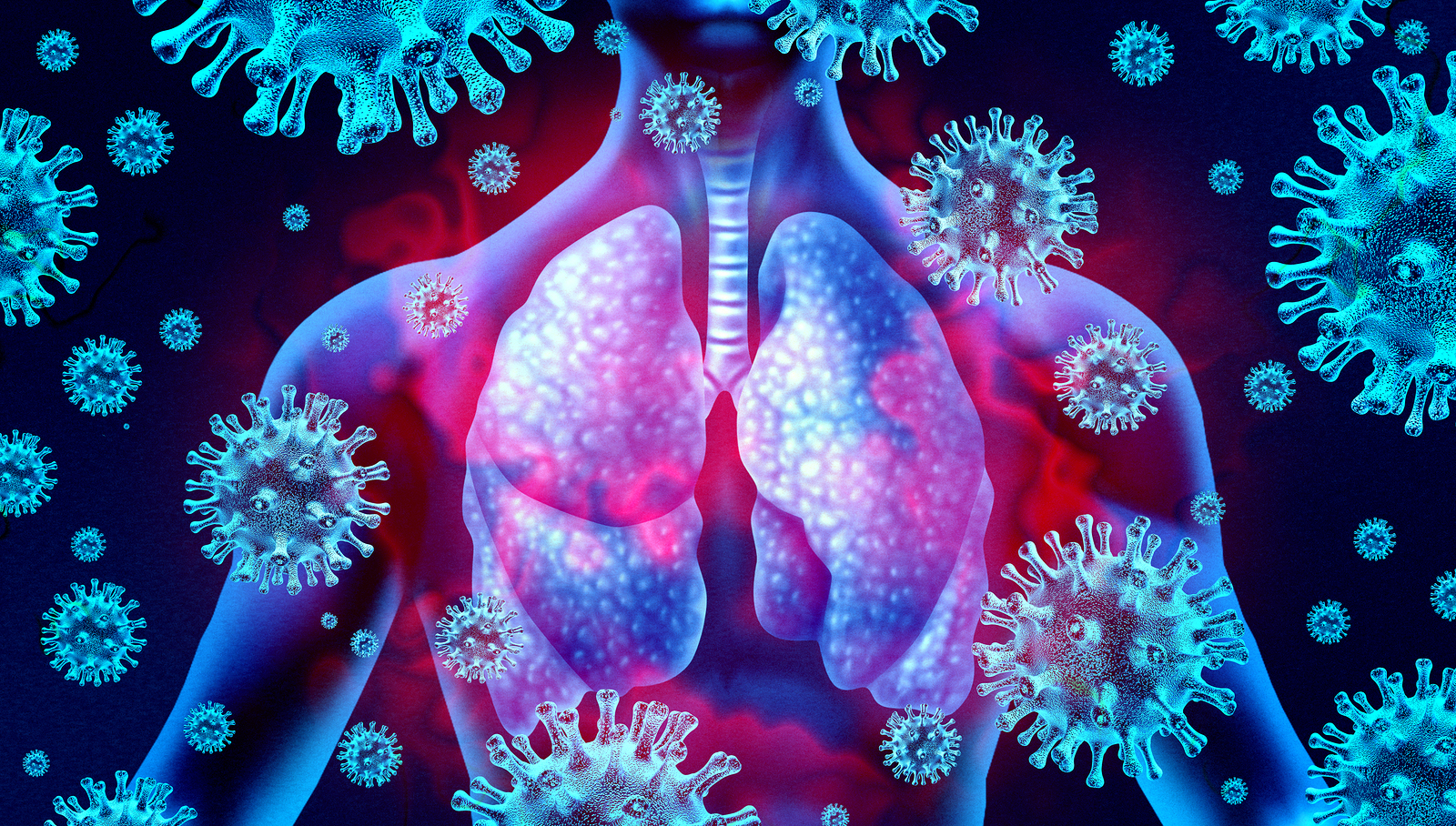 Lung Infection with Pneumonia (Viral)