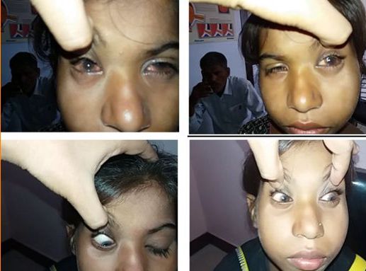 Case: Allergic Conjunctivitis 2