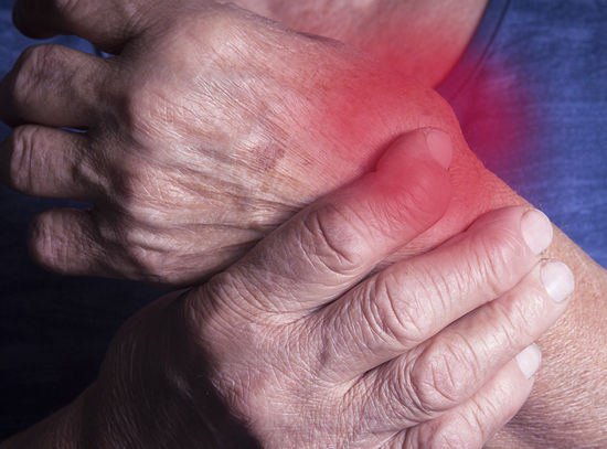 Remedies for Arthritis 2