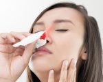 Epistaxis and Homeopathy 1
