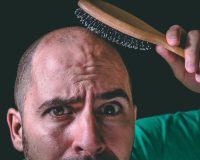 Homeopathy Best for Hair Loss 5