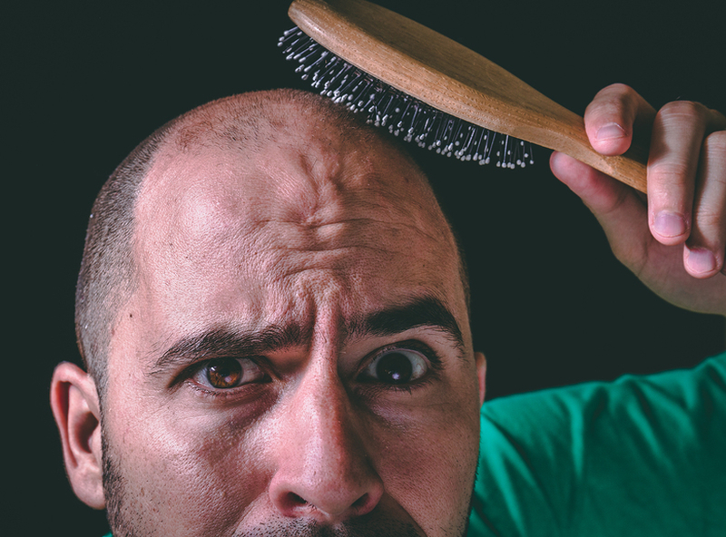 Homeopathy Best for Hair Loss 2