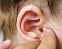 Troubled Ears and Homeopathy 1