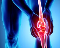 Remedies for Osteoarthritis 2