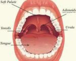 Adenoids Remedies for Enlarged Adenoids Remedies for Enlarged Adenoids 1