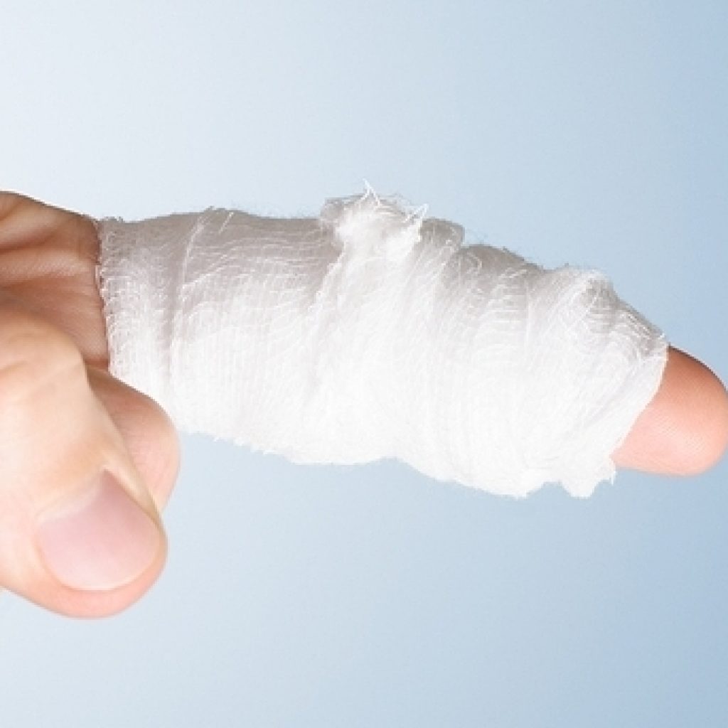 Things That Happen To Fingers Homeopathy Plus