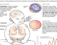 Homeopathy and Measles 2