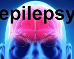 Seizures Homeopathy, Seizures & Children Homeopathy, Seizures & Children 1