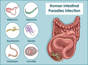 Homeopathic Medicine for Worms