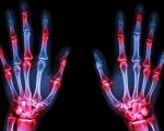 Remedies for Finger Joint Pain 1