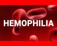 Research Studies on Haemophilia 8