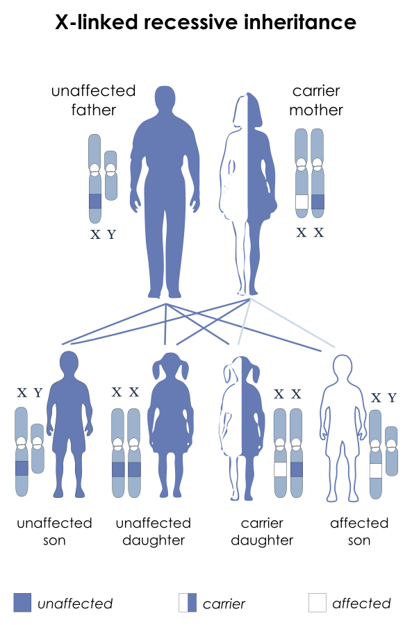 An image showing a diagram of x-linked recessive inheritance. 