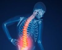 Homeopathy for Osteoporosis 5