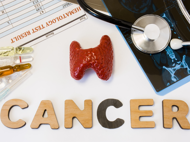 Thyroid Cancer & Homeopathy 9