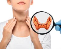 Top 5 Remedies for Hypothyroidism 1