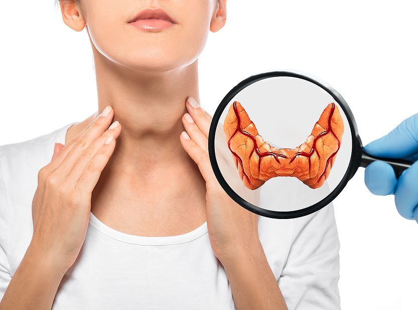 Top 5 Remedies for Hypothyroidism 2