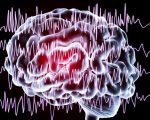Epilepsy Epilepsy and Its Management Epilepsy and Its Management 1