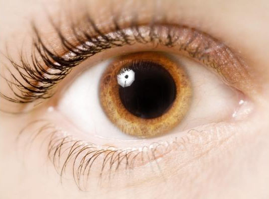 An eye stares at the viewer. They can be swelled and inflamed by iritis, with complications leading up to blindness.

