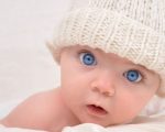 Atopic Dermatitis in Infants 10