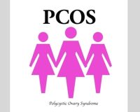 Treatment of Polycystic Ovarian Syndrome 1
