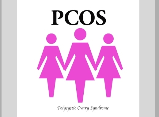 Treatment of Polycystic Ovarian Syndrome 2
